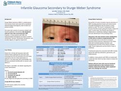 Glaucoma secondary to Sturge Weber Syndrome